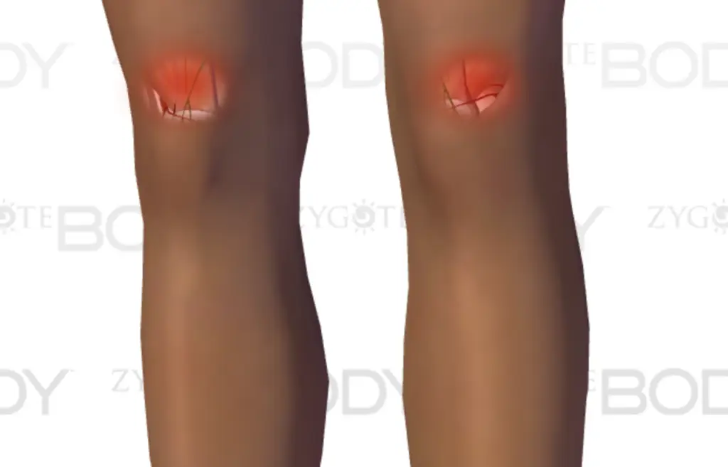 knie